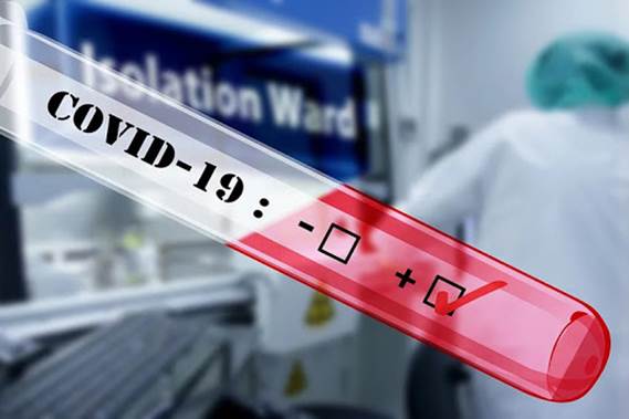 ¿Cómo se diagnostica el COVID-19?